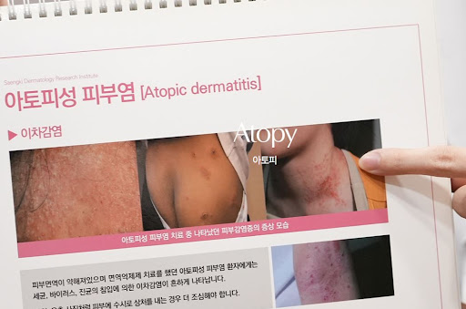 생기한의원이 안내하는 아토피 생활관리 기본 정보